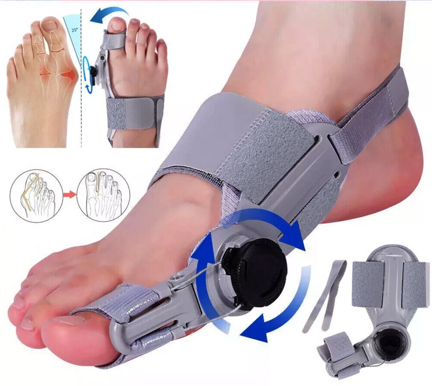 Bunion Fix Device